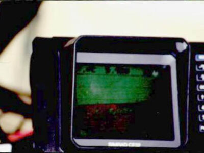 screen