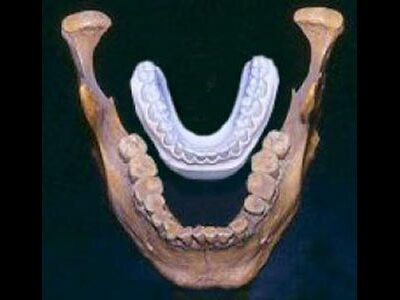 gianthumanjaw